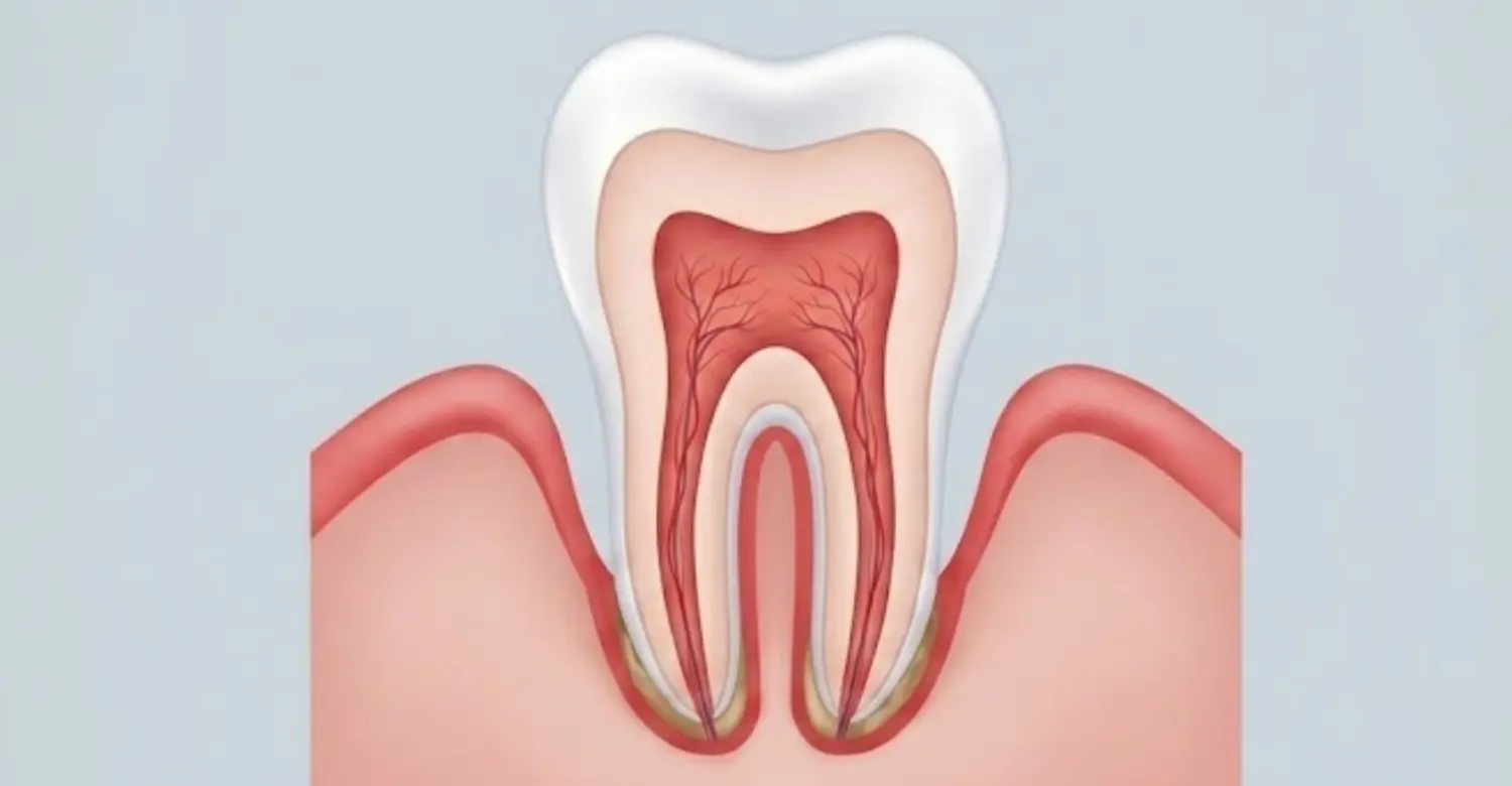 What Are Gum Diseases 2
